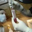 Testele de sange ar putea detecta tendintele suicidare Testele de sange ar putea detecta tendintele suicidare