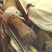   S-a electrocutat in timp ce incerca sa fure componente neferoase