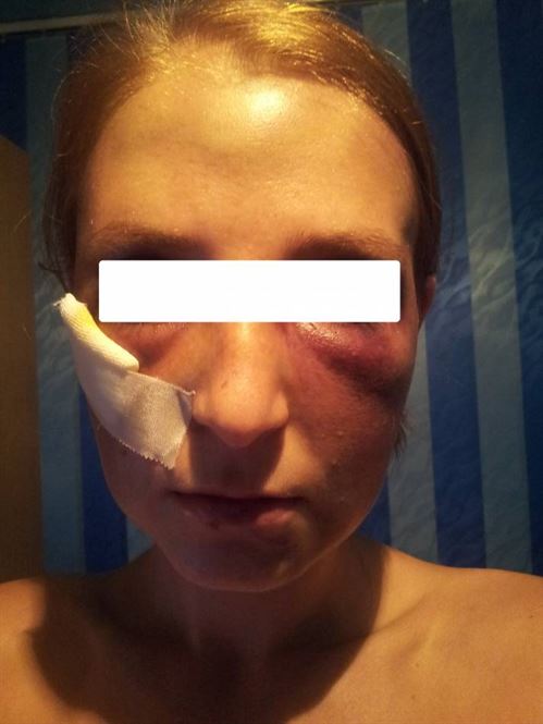 Femeie agresata intr-un local din Braila